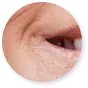 Zóna 3: Nos, tváře a rty